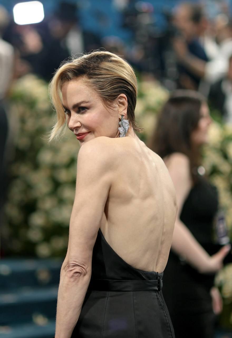 Это Николь Кидман. Ей 57. В интернете обсуждают, что у нее СТАРЫЕ ЛОКТИ. 

Во-первых, я не знала, что локти тоже умеют стареть. Про колени знаю, про локти слышу впервые. Во-вторых, я все утро смотрю на свои - при некоторых ракурсах они тоже старые!!! В-третьих, чего еще нам опасаться? Старых ноздрей? Старых ногтей?

У вас старые локти, девочки? Срочно посмотрите.